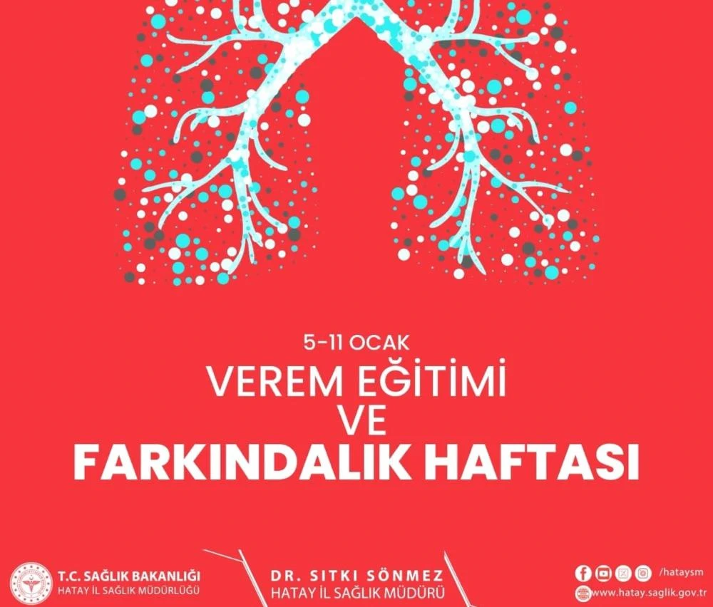 Hatay İl Sağlık Müdürü Sönmez: "Tüberkülozla Mücadelede Kararlıyız"