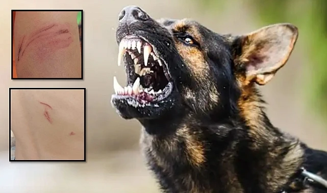 Şanlıurfa Hilvan\'da Köpek Dehşeti! Küçük Çocuğu Isırdı